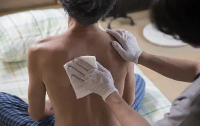 身体の清潔ケアと日常生活の支援